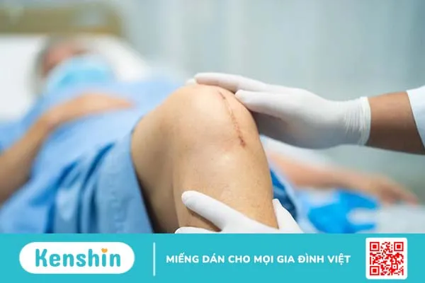 Cắt chỉ còn sót có sao không? Các loại chỉ khâu trong phẫu thuật2