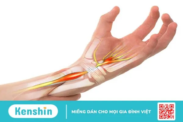 Cấu tạo bàn tay và chức năng của bàn tay 1