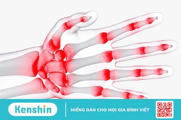 Cấu tạo bàn tay và chức năng của bàn tay 2