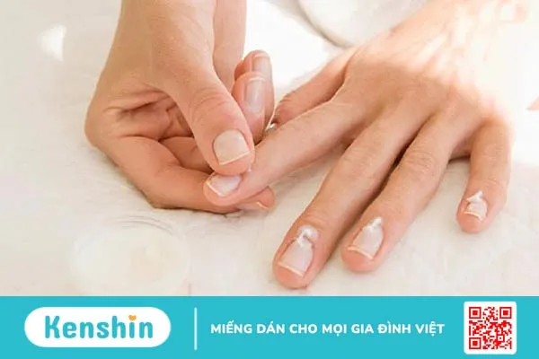 Cấu tạo bàn tay và chức năng của bàn tay 4