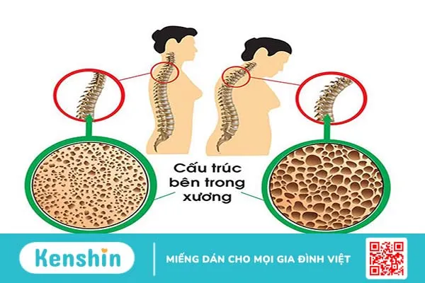 Cây cải ngọt bao nhiêu calo và công dụng của cây cải ngọt -3