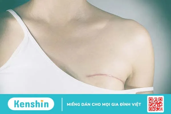 Chăm sóc tại gia đình sau phẫu thuật - Dành cho bệnh nhân ung thư vú 2