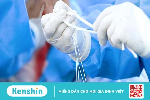 Chấn thương dây chằng khuỷu tay và phương pháp điều trị 3