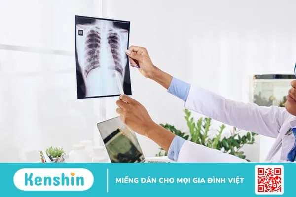 Chấn thương phần mềm xương sườn: Triệu chứng và cách điều trị 3