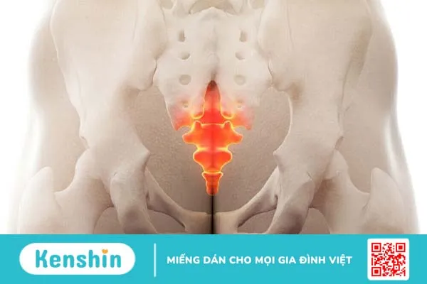 Chấn thương xương cụt: Nguyên nhân, triệu chứng, cách điều trị 1