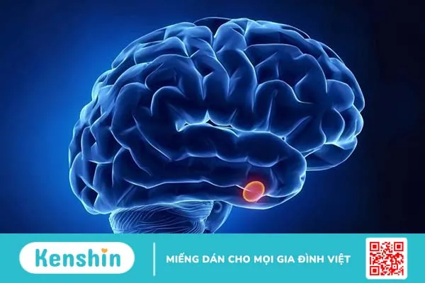 Chảy máu tuyến yên là gì? Triệu chứng và nguyên nhân gây chảy máu tuyến yên 1