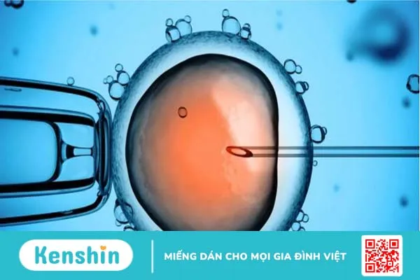 Chi phí thụ tinh ống nghiệm giá bao nhiêu 1