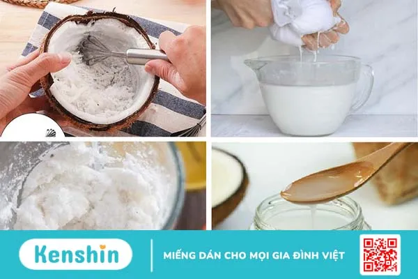 trị rạn da sau sinh bằng dầu dừa 5