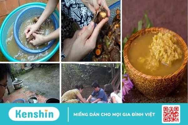 trị rạn da sau sinh bằng rượu gừng nghệ 4