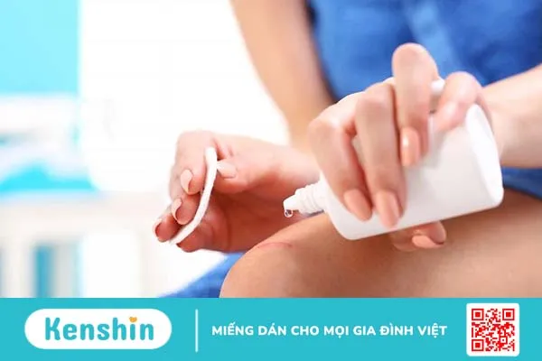 Chia sẻ thông tin 2 nhóm thuốc trị chốc lở ở trẻ em hiệu quả  1