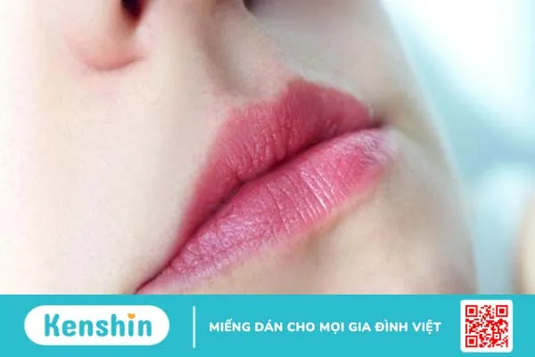 Con đường lây nhiễm chốc mép