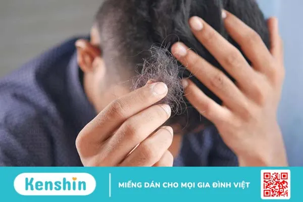 Chu kỳ tăng trưởng tóc diễn ra như thế nào? 4