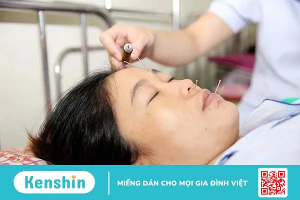 Chữa bệnh liệt mặt lâu năm có hy vọng không?