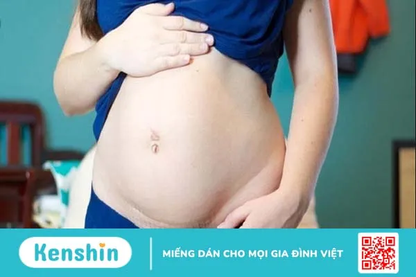 Chửa ở vết mổ có nguy hiểm đến sức khỏe không?2