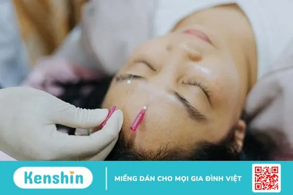 Chứng liệt dây thần kinh số 7 có tự khỏi không?