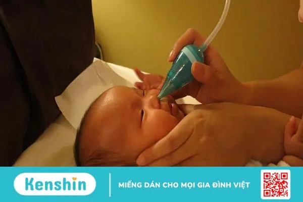 Cha mẹ có nên hút mũi cho trẻ sơ sinh không ?-1