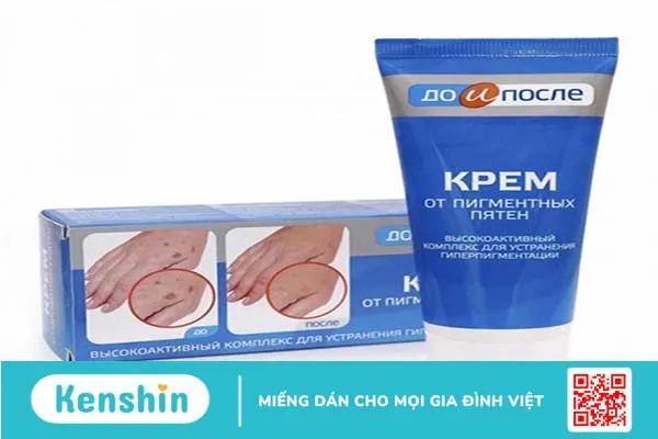 Có nên sử dụng kem trị đồi mồi ở tay Kpem? 4