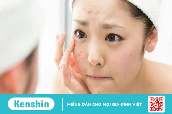 Công dụng của dầu mù u đối với sức khỏe và làm đẹp 2