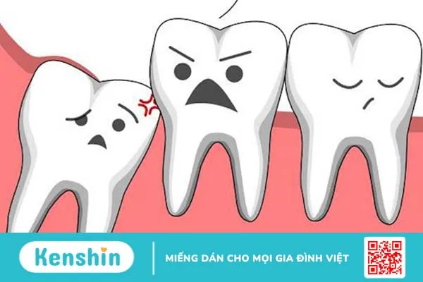 Công nghệ nhổ răng khôn mới nhất hiện nay