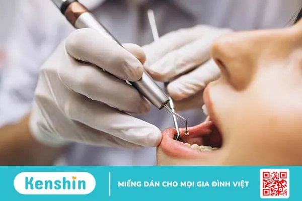 Công nghệ nhổ răng khôn mới nhất hiện nay