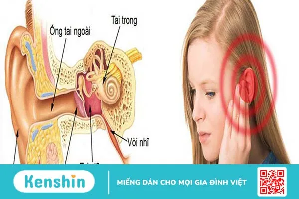 Tắc vòi nhĩ là một trong những nguyên nhân gây viêm tai giữa ứ dịch