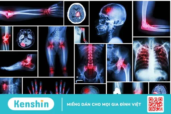 Đa chấn thương: Mức độ nguy hiểm và cách xử trí 1