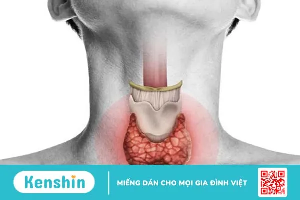 Chi tiết đánh giá hạch tuyến giáp và dấu hiệu nhận biết ung thư tuyến giáp 1