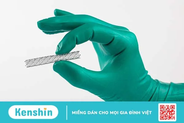 Đặt stent mạch vành và những điều cần biết 2