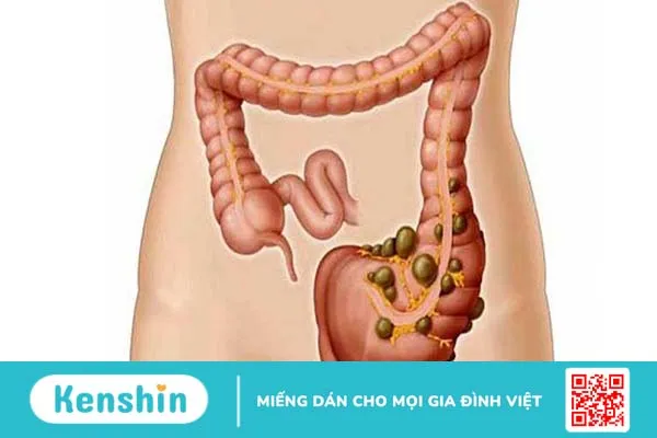 Đau bụng bên trái: Những nguyên nhân thường gặp và cách xử lý 2