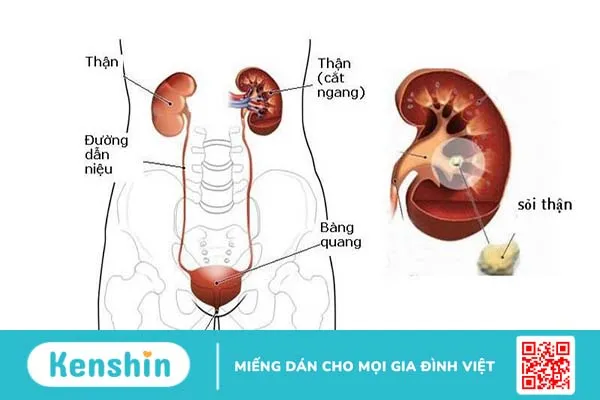 Đau bụng bên trái: Những nguyên nhân thường gặp và cách xử lý 5