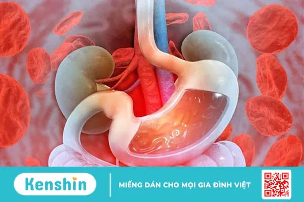 Đau bụng bên trái: Những nguyên nhân thường gặp và cách xử lý 7