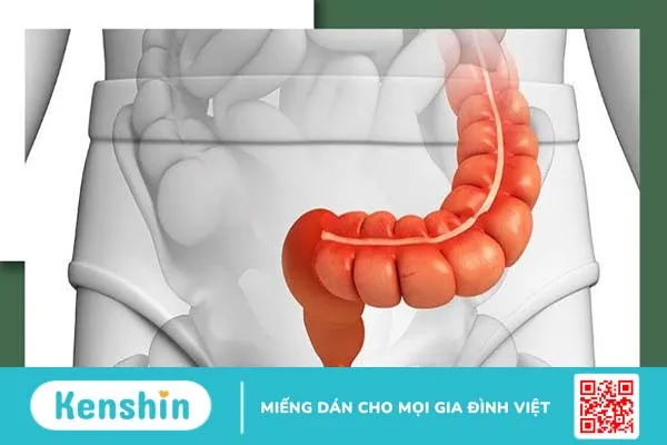 Đau bụng bên trái: Những nguyên nhân thường gặp và cách xử lý 6