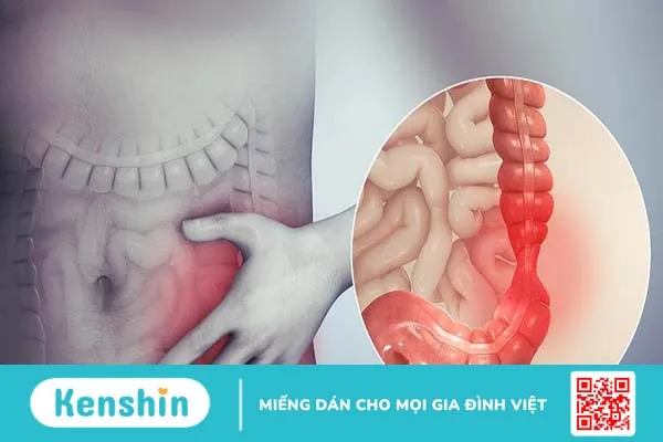 Đau bụng dưới rốn có sao không?Đau bụng dưới rốn có sao không? 2