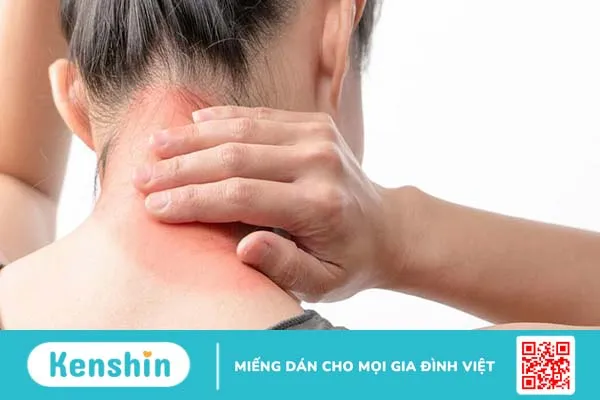 Đau cơ xơ hóa: Triệu chứng, nguyên nhân và cách chữa trị 3