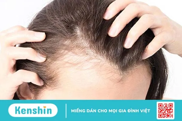 Dầu gội Jasunny có dùng được cho bà bầu không? Lưu ý cho mẹ bầu khi dùng sản phẩm 3