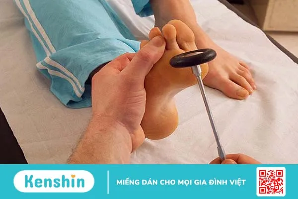 Dấu hiệu Babinski là gì? Cách khám và chẩn đoán dấu hiệu Babinski 2