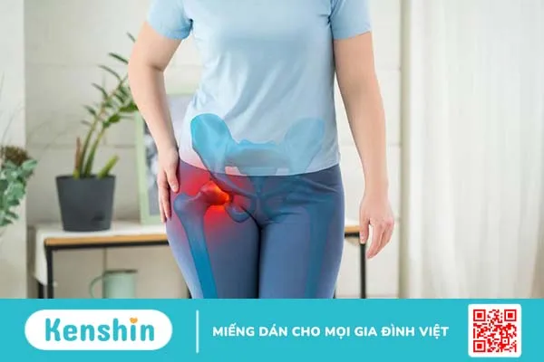 Đau hông phải là bệnh gì? Khi nào nên đến gặp bác sĩ?