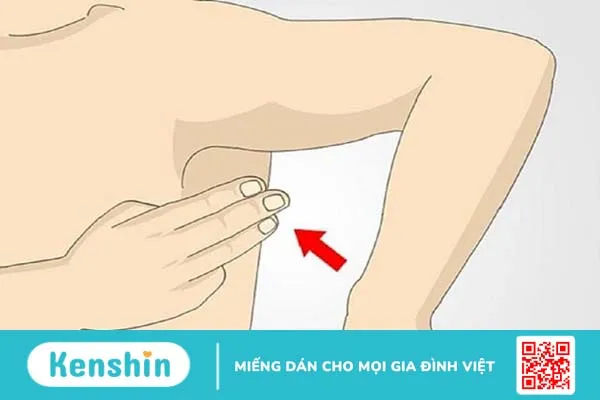 Đau nách nhưng không nổi hạch là vì sao? Cách xử lý tình trạng này thế nào? 1