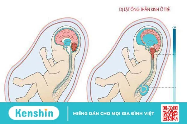 Đậu răng ngựa: Thực phẩm bổ dưỡng và đa năng 2