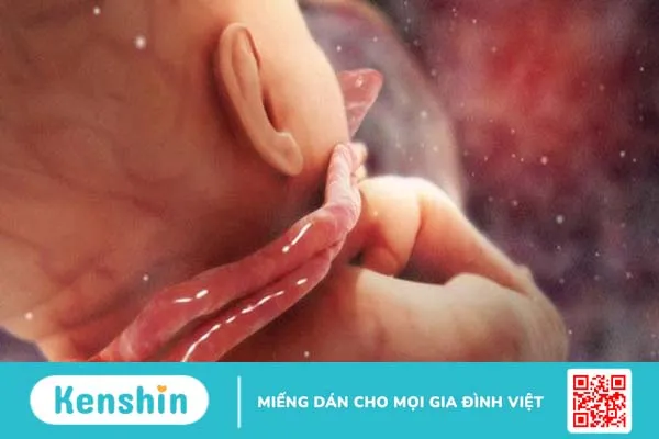 Dây rốn quấn cổ 1 vòng tuần 32 có nguy hiểm không? Cách xử lý như thế nào? 1