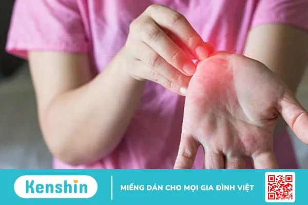 Dị ứng bột giặt: Nguyên nhân, dấu hiệu nhận biết và cách khắc phục 2