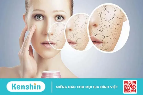 Dị ứng cồn trong mỹ phẩm: Dấu hiệu nhận biết và cách xử lý 3