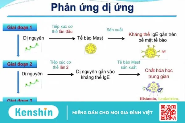 Dị ứng động vật có vỏ: Triệu chứng, nguyên nhân và cách xử trí 3