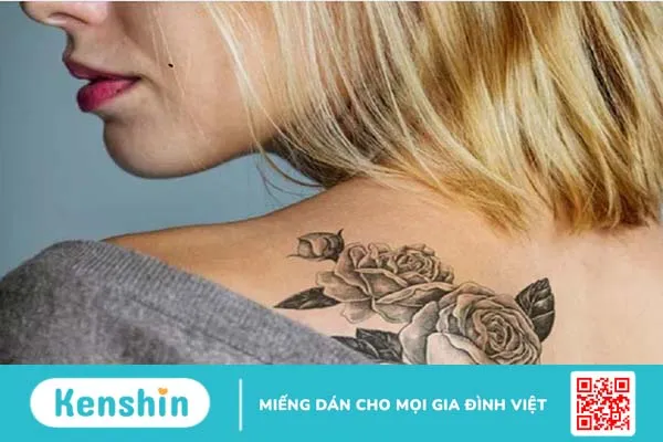 Dị ứng mực xăm là thế nào? Cách nhận biết và điều trị da bị dị ứng sau khi xăm 4