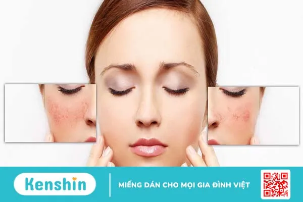 Dị ứng mỹ phẩm có tự hết không? 1