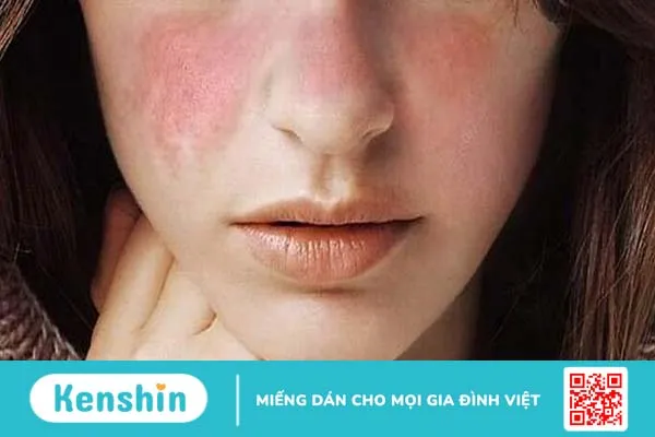 Dị ứng mỹ phẩm có tự hết không? 2