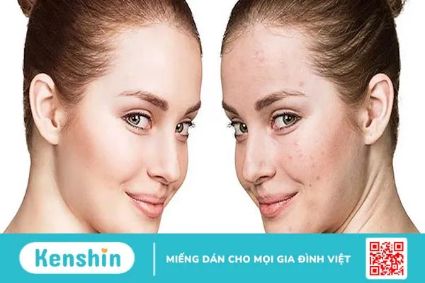 Dị ứng mỹ phẩm nên bôi thuốc gì? 3