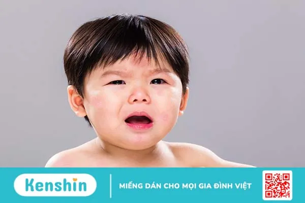 Dị ứng thức ăn ở trẻ: Dấu hiệu nhận biết và cách xử lý kịp thời 1