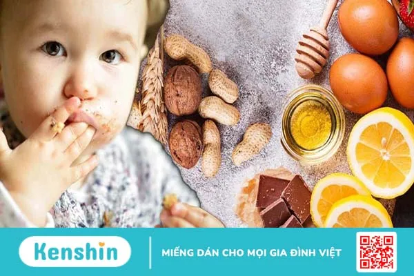 Dị ứng thức ăn ở trẻ: Dấu hiệu nhận biết và cách xử lý kịp thời 2