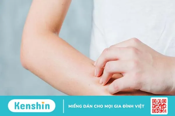 Dị ứng với cây họ đậu là thế nào? Triệu chứng nhận biết và cách điều trị ra sao? 2